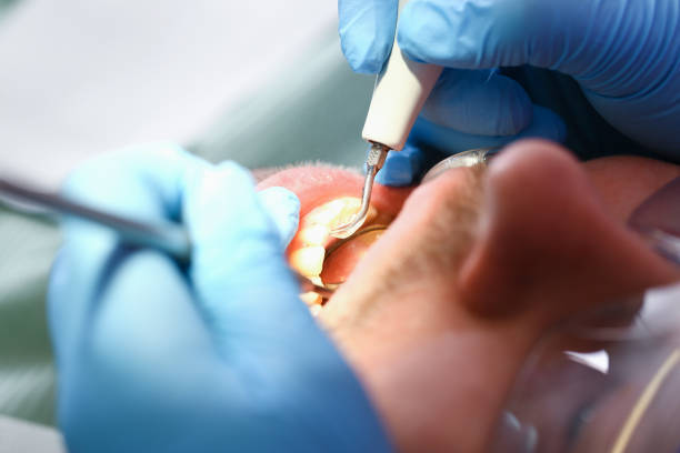 Best Broken or Cracked Tooth Emergency Dentist in Callaway, MD